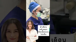  ผ่าตัดรักษาภาวะม่านตาบางด้วยวิธีใด และมีข้อดีอย่างไร 