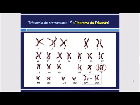 Download MP3 Cromossomos Autossomos Cromossomos Sexuais e Trissomia