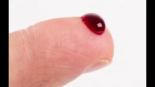 بینینی خۆێن لە خەوندا 