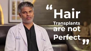 Hair Transplants Are Not Perfect!