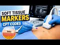Soft Tissue Marker Placement CPT Codes