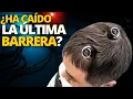 Download Lagu Comienza expansión de chips: Neuralink inicia implantes cerebrales fuera de EE. UU. |¿Alerta global?