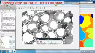 MATLAB WATERSHED SEGMENTATION
