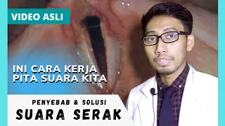 Download Penyebab dan Solusi Suara Serak, Respon Pita Suara Terhadap Menyanyi, Infeksi, Stroke, Tumor MP3