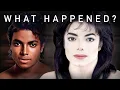 Michael Jackson s Skin The Truth About Vitiligo Depigmentation and Bleaching the detail