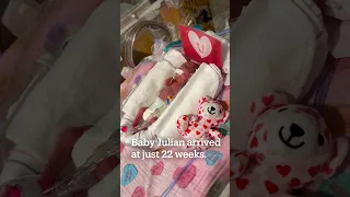 Baby born at 22 weeks A NICU miracle Tufts Medical Center