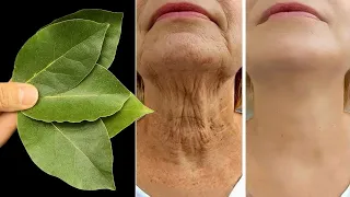  this plant heals everything botox collagen varicose veins joints