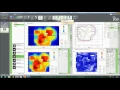 Download Lagu myQA Patients Software Demo Webinar