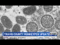 What you need to know about monkeypox symptoms how its spread