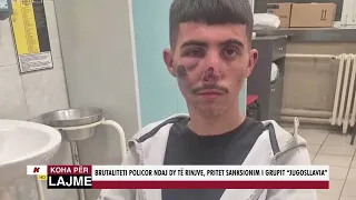 BRUTALITETI POLICOR NDAJ DY TË RINJVE, PRITET SANKSIONIM I GRUPIT “JUGOSLLAVIA”