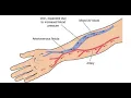 Repair Arteriovenous Fistula CPT code - simplify medical coding
