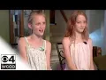 Conjoined Sisters Celebrate 10 Years Apart
