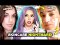 Viral TikTok EXPOSES Celebrity Esthetician: ‘She RUINED My Face’ | Influencer Disaster