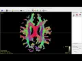Whole-brain tractography on the HCP example data using MRtrix3