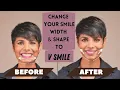 Download Lagu How to CHANGE Your SMILE Width and Shape to V SMILE