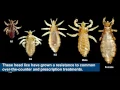 Household product safely cures drug resistant head lice