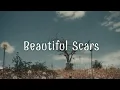Download Lagu 《我不會隱藏這些美麗的傷疤》Maximillian - Beautiful Scars  中英字幕 ∥ 西洋歌曲推薦 #61