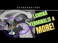Download Lagu 🧠 Lamina Terminalis \u0026 Voorste Derde Ventrikel | Neuroanatomie Vereenvoudigd! 🧠