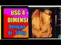Download Lagu Proses USG ( Part 2) Di Bidan Elina