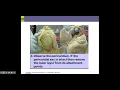 1 Chapter 11 Cardiovascular Intro