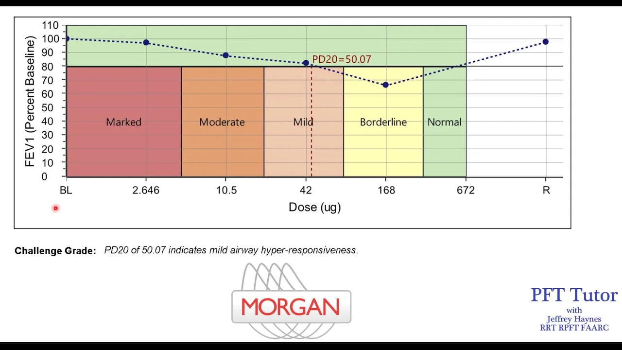 Methacholine Challenge Testing