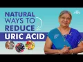 Download Lagu Effective Uric Acid Reduction | Relief for Swollen Joints, Joint Pain \u0026 Gout Naturally | Dr. Hansaji