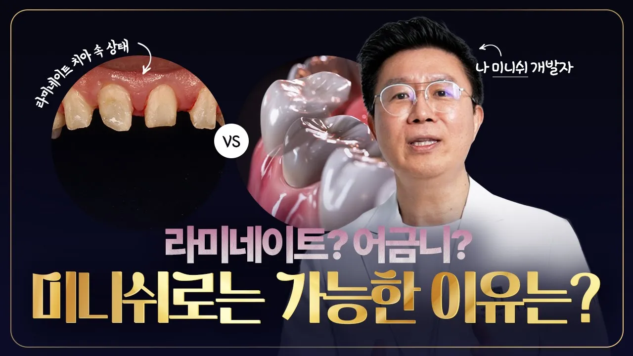 라미네이트와 어떤 차이가 있을까 | 손상된 어금니까지도 가능하다면? 미니쉬 !