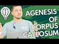 Agenesis of Corpus Callosum brain disorder explained simply