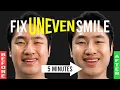 Lagu 5-minuten routine voor het verhelpen van een ongelijkmatige glimlach｜Gebruik dit vóór een belangr...
