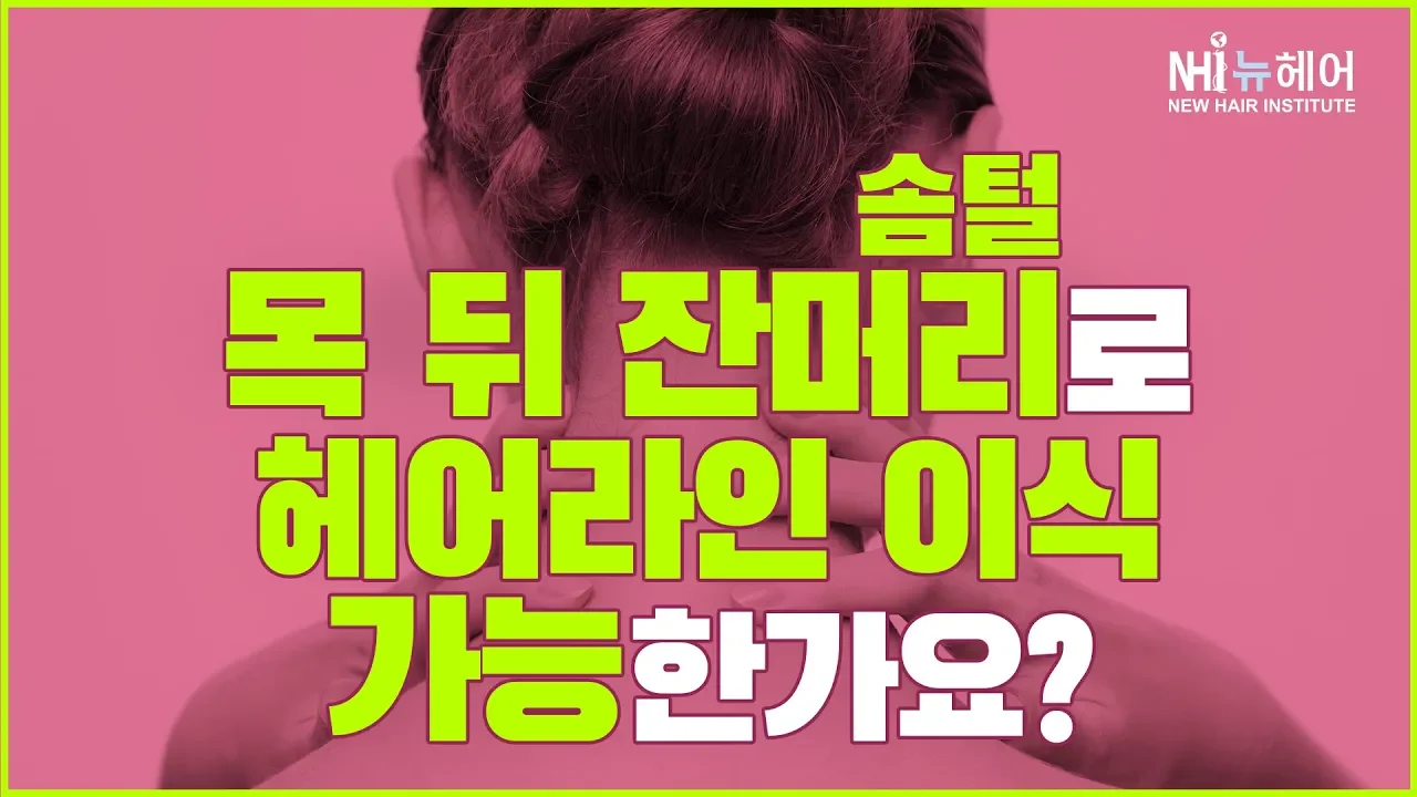 목 뒤 잔머리 뽑아서 헤어라인 이식이 가능한가요? - 뉴헤어 I 모발이식 I 탈모QnA I