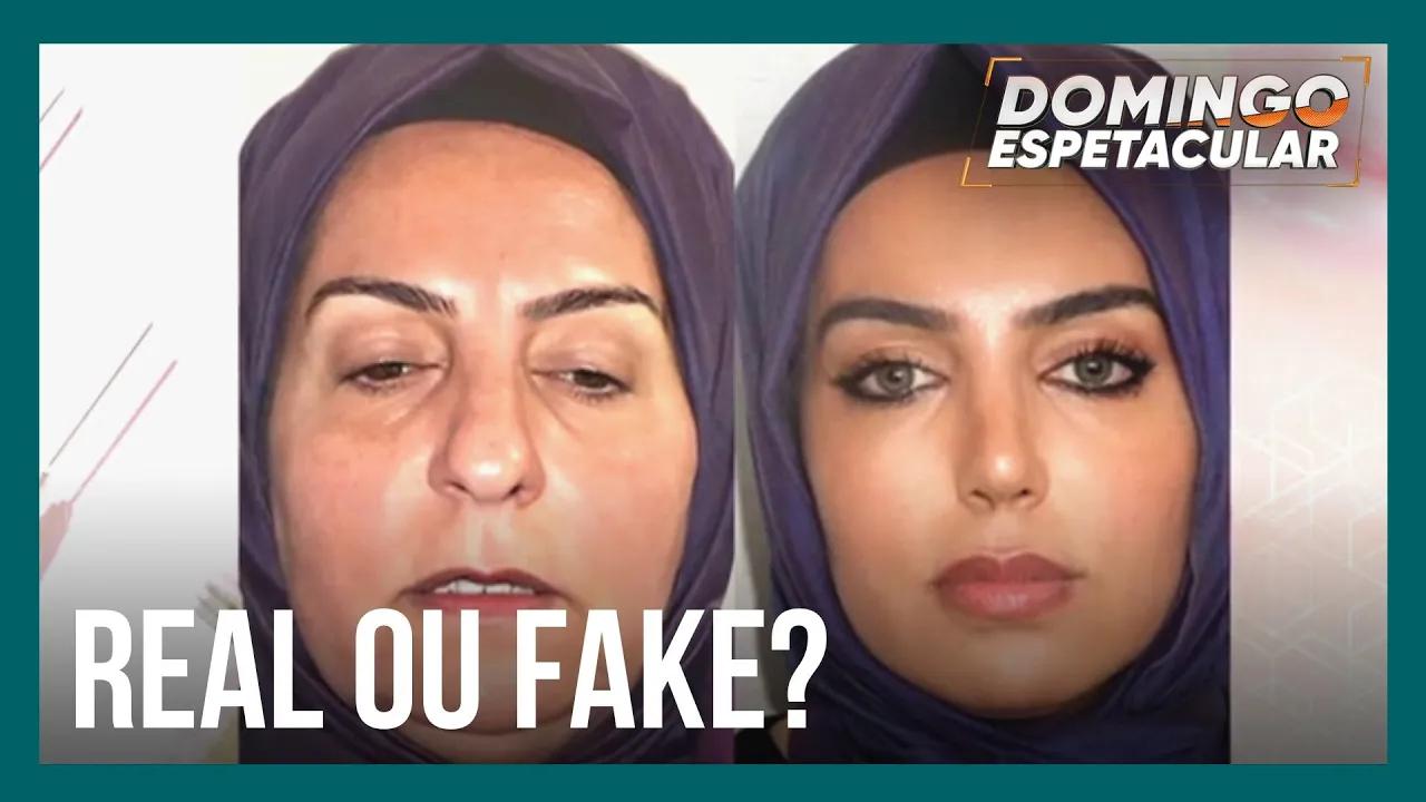 Domingo Espetacular vai à Turquia para investigar transformação visual que agitou a internet