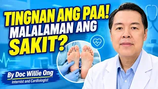 Tingnan ang Paa Para Malaman ang Sakit. - By Doc Willie Ong (Internist and Cardiologist)
