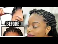 HOW TO REFRESH BOX BRAIDS EDGES AND HAIRLINE Journeytowaistlength