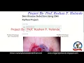 Skin Disease Detection Python Code Skin Disease Detection Using CNN With Source Code DiseaseDetect