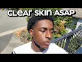 how to get clear skin for guys asap