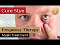 Download Lagu Heal Stye Eye Music Therapy ๏ Rife Frequency Bioresonance Treatment ๏ Healing Nature Frequencies
