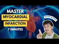 Download Lagu MYOCARDIAL INFARCTION for NCLEX \u0026 PNLE 2025