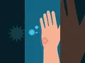 How Often Should You Get A Tetanus Shot