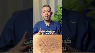                                                                                                   دندنها