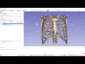 How to enable GPU volume rendering in 3D Slicer