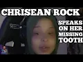 CHRISEAN ROCK SPEAKS ON HER MISSING TOOTH
