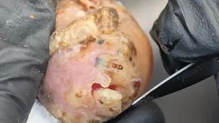 أول عملية حفر جيجر لماكسيميلا نغوتا شاهد الفيديو الطويل على Riseupsociety Net و Ruskenya Org 