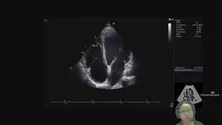 24 3d Types of Ultrasound Scans in Diagnostic Imaging A2 Medical Cambridge A Level Physics