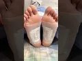 Download Lagu Detox Foot Patches