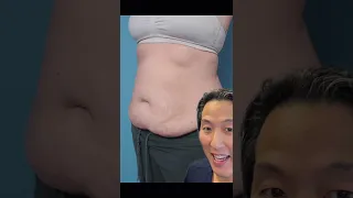 Tummy Tuck REVEAL Shorts Tummytuck 