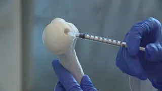Chicago scientists develop revolutionary cartilage regeneration technology