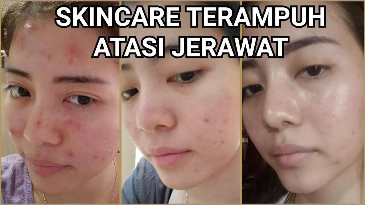 Tips memilih Skincare & Make Up KULIT SENSITIF - SKIN BARRIER | Clarin Hayes. 