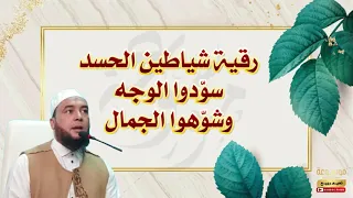 رقية الحسد سو د الوجه وشو ه الجمال الراقي المغربي نعيم ربيع 