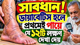 পায়ে এই ১২টি লক্ষণ দেখলে সাবধান || পায়ের যে পরিবর্তনগুলো কখনো অবহেলা করবেন না!