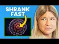 Her Tumor SHRANK in Just Weeks Here s What She Did